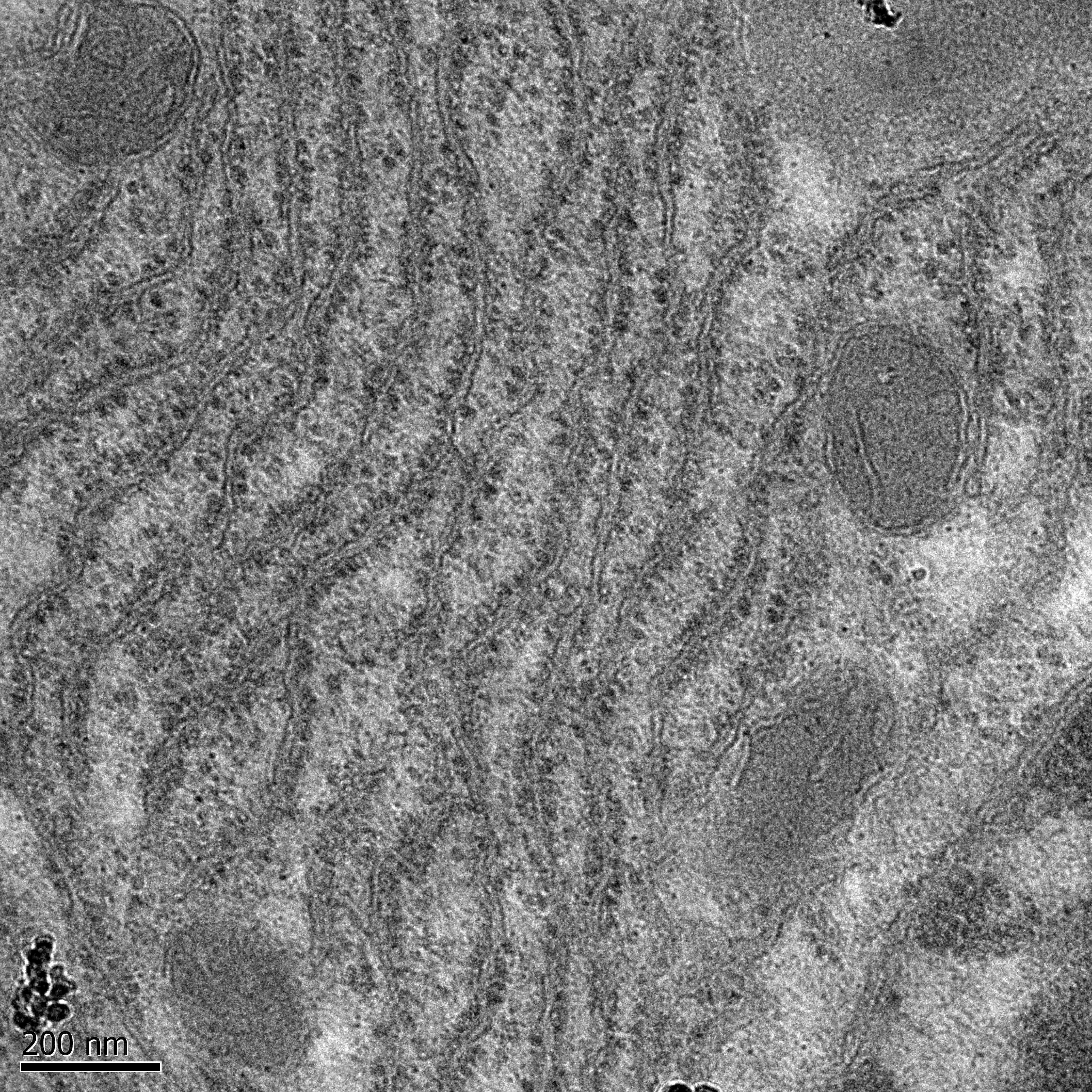 Image courtesy Electron microscope unit University of Cape Town